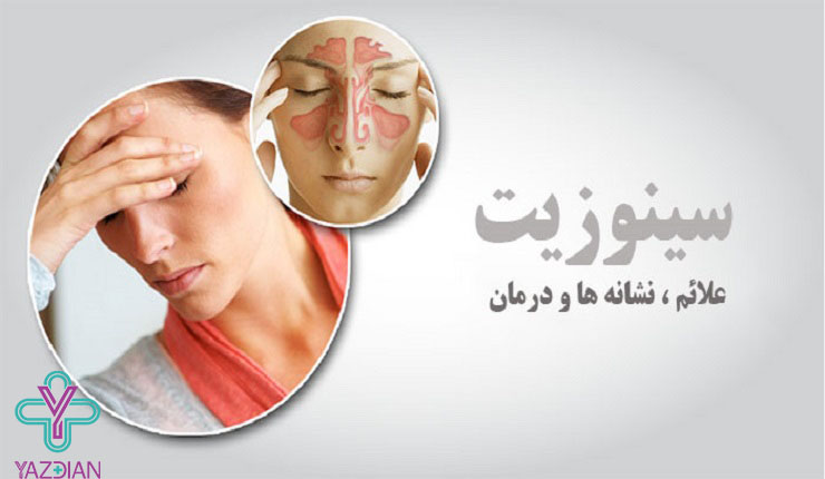 سینوزیت آلرژیک چگونه درمان می شود؟ سینوزیت آلرژیک چگونه درمان می شود؟